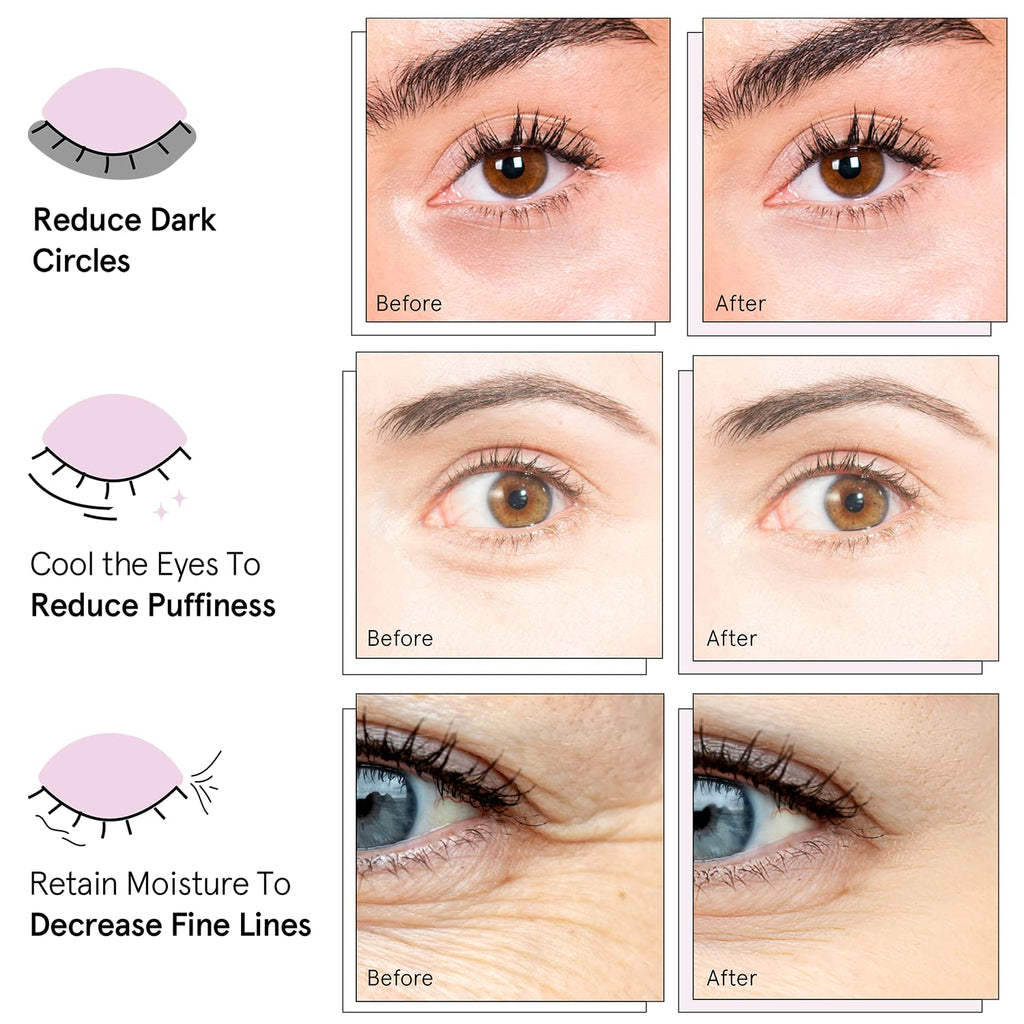 grace & stella Under Eye Mask (Gold, 48 Pairs) Eye Patch, Under Eye Patches for Dark Circles and Puffiness Undereye Bags, Wrinkles - Gel Under Eye Patches - Small Gifts - Vegan Cruelty-Free Self Care-UPStoxs